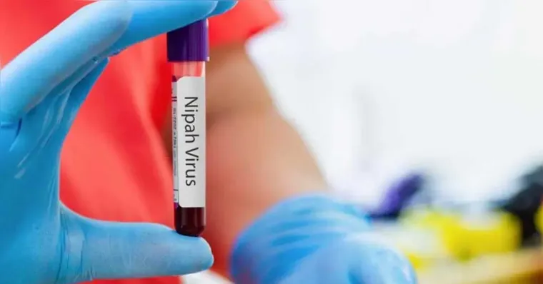Ministério da Saúde emite alerta sobre vírus Nipah no Brasil