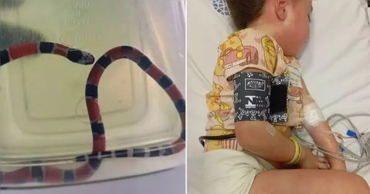 Menina é picada por cobra coral e sofre choque anafilático