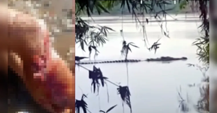 O pescador teve a perna dilacerada devido o ataque do jacaré | Reprodução